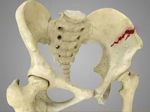 Pelvis Academic bone replica
